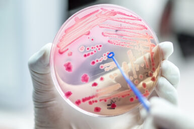 A close up of a hand holding a petri dish with resistant bacteria present