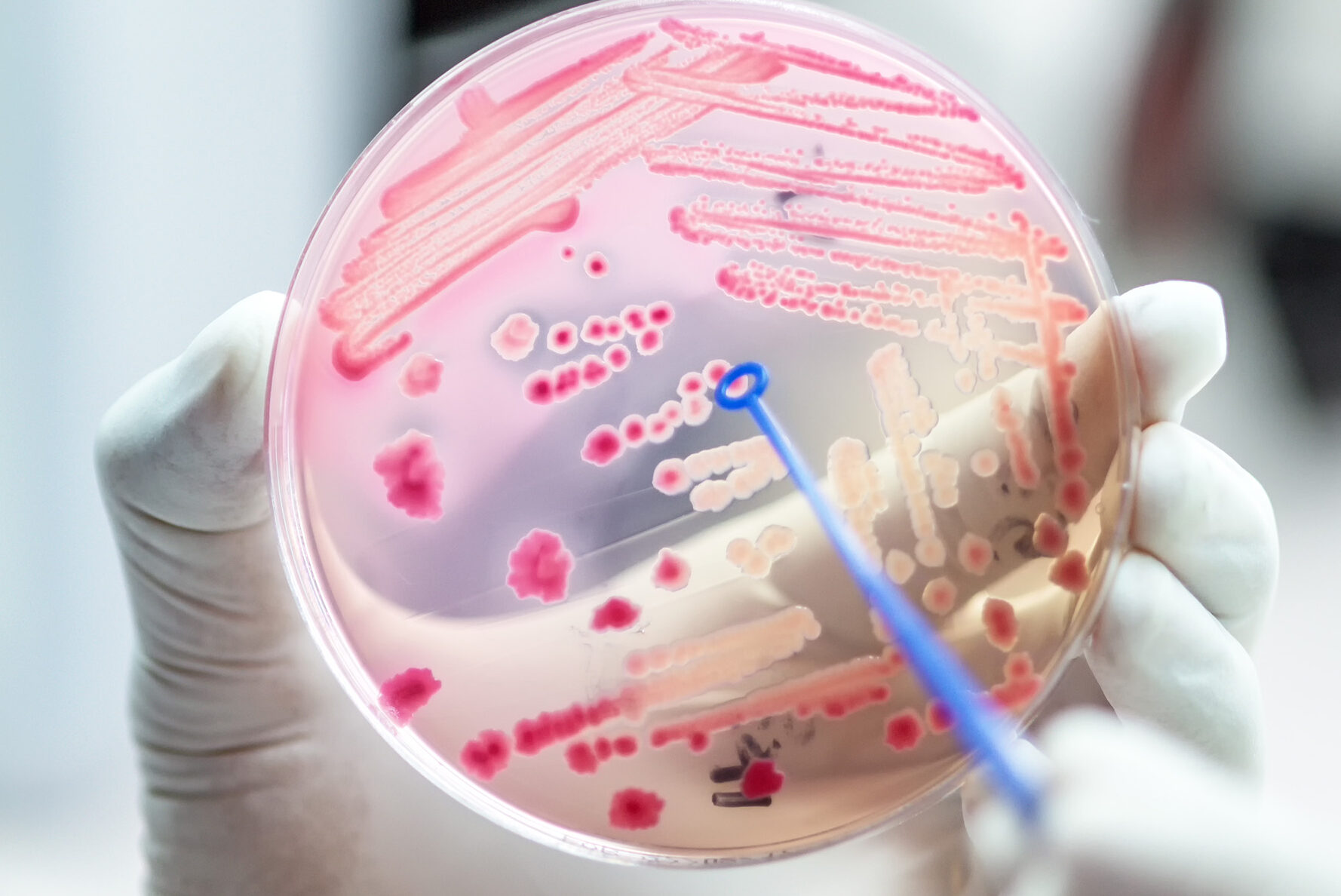 A close up of a hand holding a petri dish with resistant bacteria present